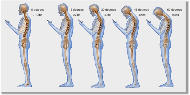 Looking at mobile devices can cause neck and shoulder pain if you have bad posture